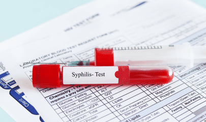 Mise en avant articles syphilis site biogroup (5) (1)