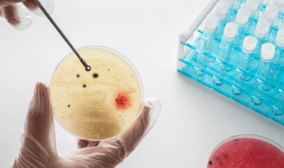 Mise en avant articles chlamydia site biogroup (20) (1)