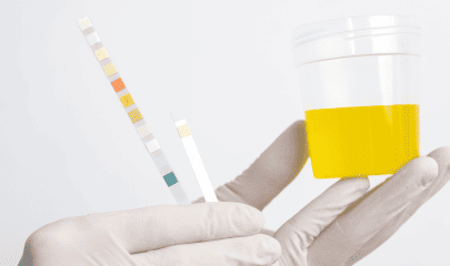 Mise en avant articles chlamydia site biogroup (22) (1)