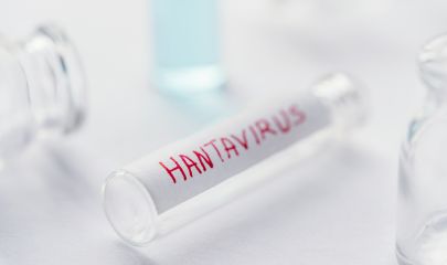 Hantavirus tube MAV